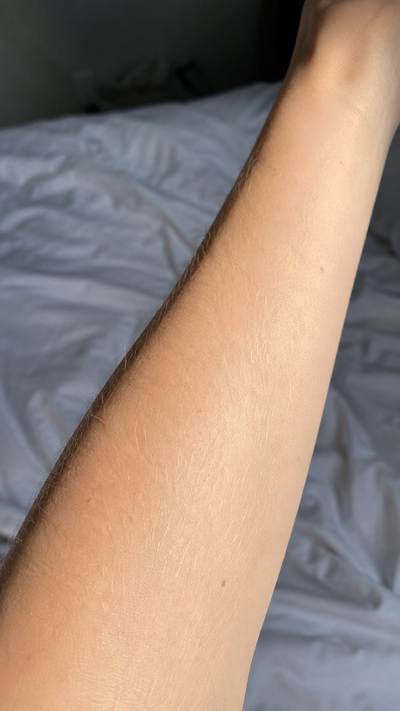 My hair's never been laser-friendly, this is